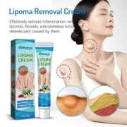 Lipoma Removal Cream-লাইপোমা রিমুভাল ক্রিম (২ পিস নিলে ১ পিস ফ্রি)