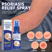 Psoriasis relief spray