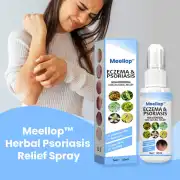Meellop™ Herbal soriasis Relief Spray