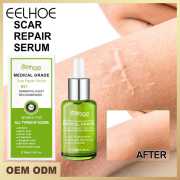 EELHOE Scar Repair Serum